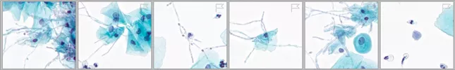 Image of cytology cells with correlated numbers