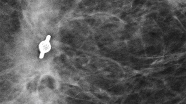 x-ray image