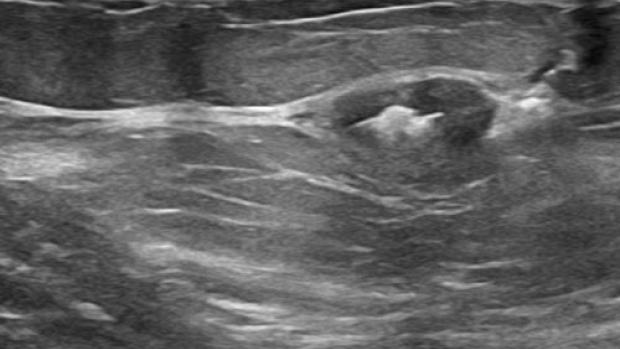 x-ray image